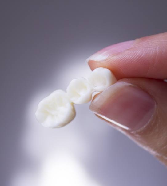 Hand holding a custom dental bridge